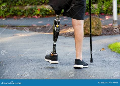 Prosthetic Leg Stock Image Image Of Sportsman Training 252071319