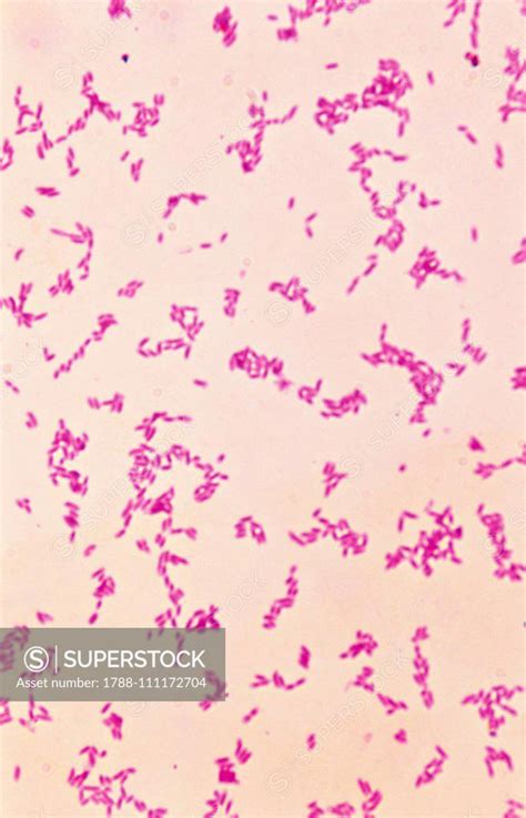 Yersinia Pestis Formerly Pasteurella Pestis The Bubonic Plague Bacterium Seen Under A