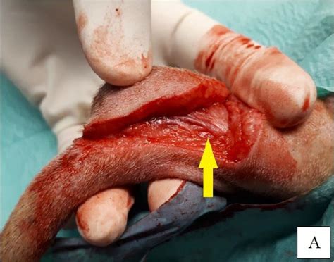 Achieving primary closure on the proximal third of the tail after 4 cm