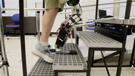 Worlds First Thought Controlled Bionic Leg Pictures Cnet