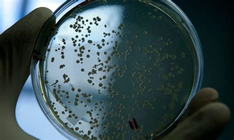 Antibiotic Resistant Superbugs Could Spread In Clinics New Research