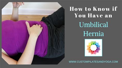 How To Know If You Have An Umbilical Hernia Youtube