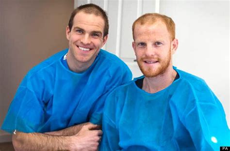 Bald Brothers Make History With Double Hair Transplant Pictures