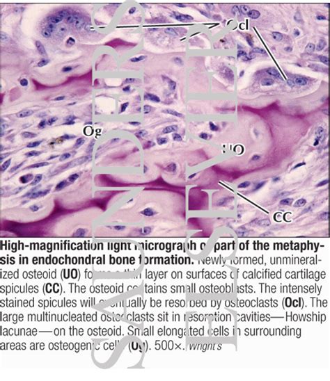 High Magnification Light Micrograph Of Part Of The Metaphysis In