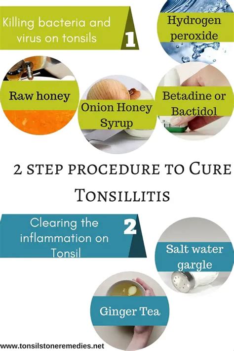 Step Procedure To Cure Tonsillitis Effectively Naturally And Completely