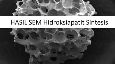 Sem Hidroksiapatit Sintesis Laboratorium Mineral Material Maju Sentral