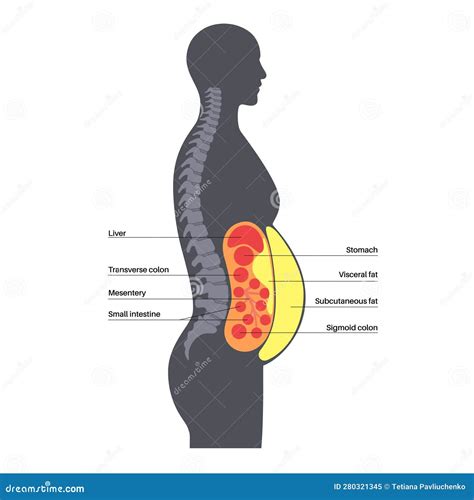 Visceral Fat Diagram Stock Vector Illustration Of Medical 280321345