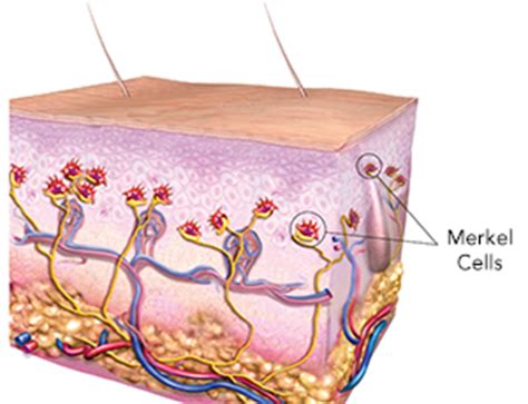 Merkel cell carcinoma (mcc) is a rare, aggressive form of skin cancer with a high risk for returning (recurring) and spreading (metastasizing), often within two to three years after initial diagnosis. Merkel Cell Carcinoma - The Skin Cancer Foundation