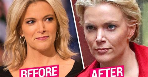 Megyn Kelly Shows Off New Cut After Getting Chopped From Nbc