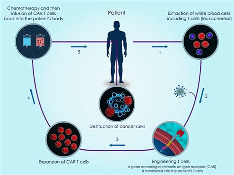 Trilink社 The Scaled Back Tale Of Car Based Therapeutics｜fount Of