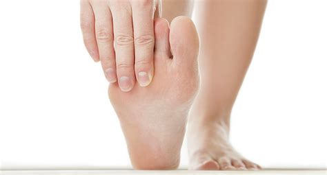 How To Determine If You Have Flat Feet South Florida Podiatry Center