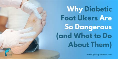 The Different Locations Of Diabetic Foot Ulcer Patients In The United