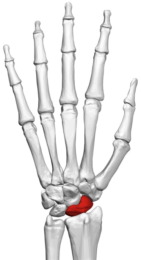 Scaphoid Fracture Aberdeen Virtual Hand Clinic