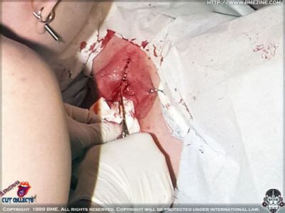 Cunt Pussy Vagina Mutilation Modification Telegraph