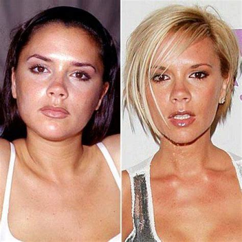 Victoria Beckham Before And After Healthy Weight Loss Lose 15