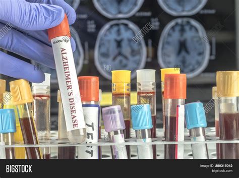 Scientist Holds Blood Image And Photo Free Trial Bigstock