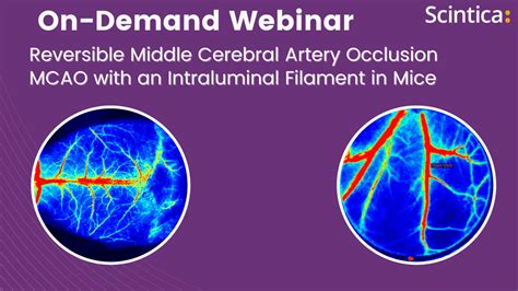 Reversible Middle Cerebral Artery Occlusion MCAO With An Intraluminal Filament In Mice Scintica