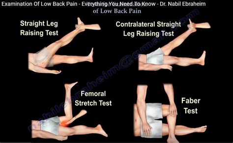 Clinical Examination For Low Back Ache —
