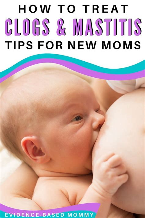 What Is Breast Engorgement Its Causes And Treatment Artofit