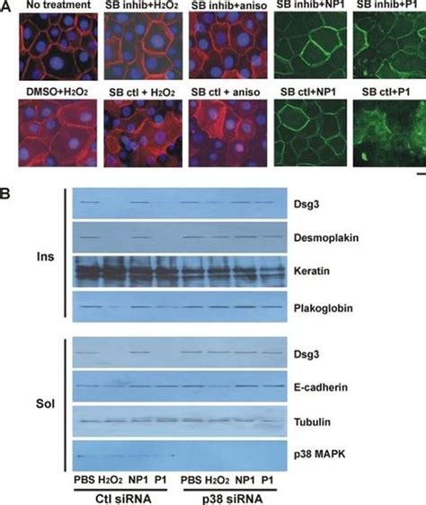 Desmoglein 3 Monoclonal Antibody 5g11 32 6300