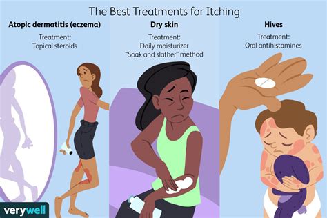 What Are The Common Causes And Treatments For Itching