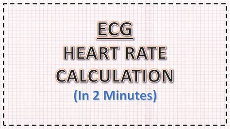 Ecg Heart Rate Calculation In 2 Minutes Ecg Interpretation Youtube