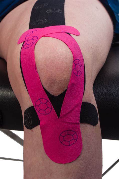 Trusted by millions, kt tape is used for common sports injuries such as itbs, runners knee, shin splints, hamstring strain, & many more. Knee Pain Kinesio Taping | Physical Sports First Aid Blog