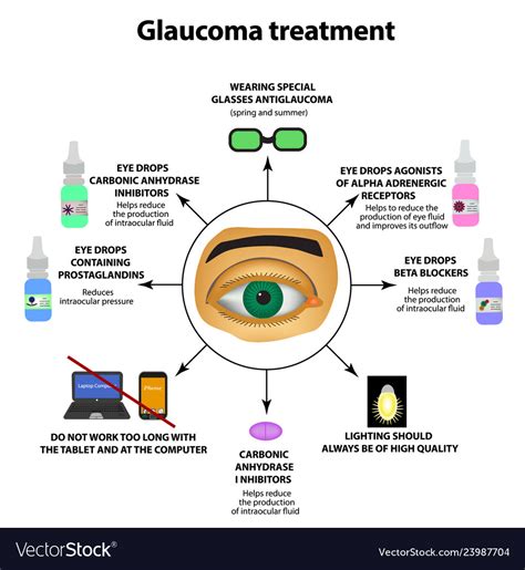 Glaucoma Eye Drop Medications Chart My Xxx Hot Girl