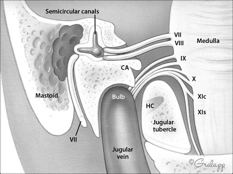 Ear Tumor Anatomy Oto Surgery Atlas