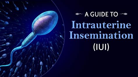 Intrauterine Insemination IUI Process For Infertility Treatment YouTube