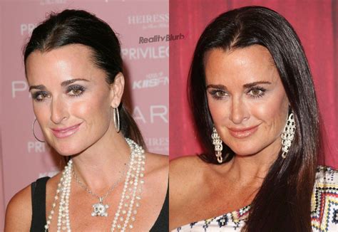 She studied at oxford university and in kyoto, japan. PHOTOS: See 'RHOBH' Kyle Richards Before & After Plastic ...