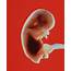 Foetus At 11 Weeks Photograph By Garry Watson