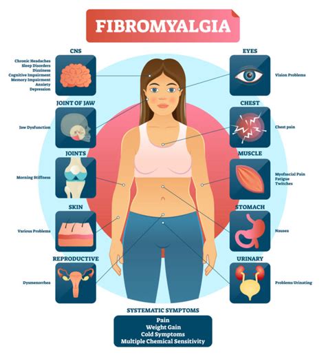 Fibromyalgia Signs Symptoms And Complications Hot Sex Picture