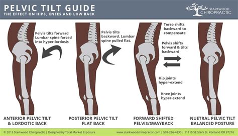 Pelvic Tilt Exercise Pinterest Tilt Therapy And Physical Therapy