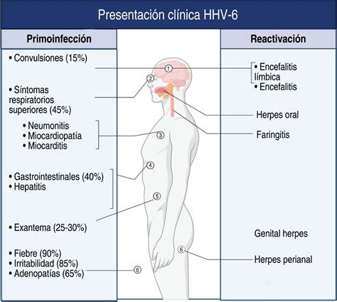 Human Herpesvirus 6 Hhv 6 Meningoencephalitis In A Pediatric Patient