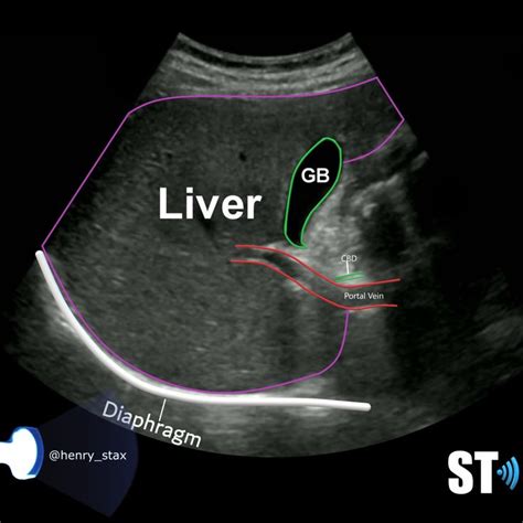 Liver Anatomy And Protocol Basics Sonographic Tendencies Ultrasound