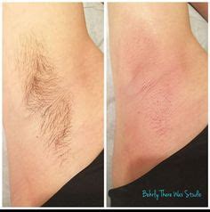 Before And After Underarm Wax Dayton Ohio Brazilianwaxing Waxing