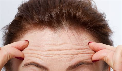 Dermatologists Reveal 6 Ways To Prevent Forehead Wrinkles Healthy Glam