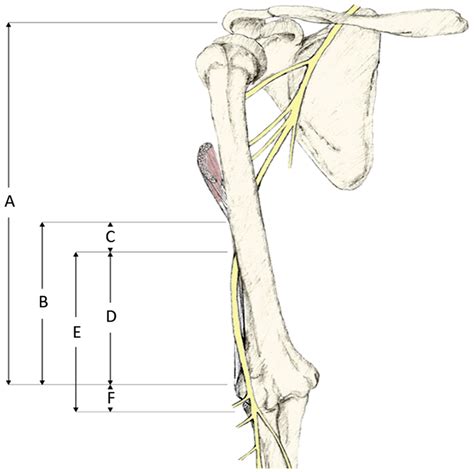 Schematic Drawing Of The Course Of The Radial Nerve In Relation To The