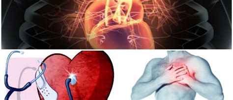 Insuficiencia Cardíaca Definición Causas Síntomas Diagnóstico