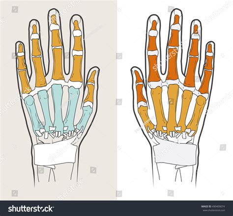 Anatomical Hands Bones Joints Ligaments Wrists Stock Vector Royalty