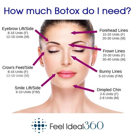 💖 How Much Botox Do You Actually Need For Each Area Of Your Face You