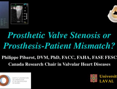 Prosthetic Valve Stenosis Or Prosthesis Patient Mismatch
