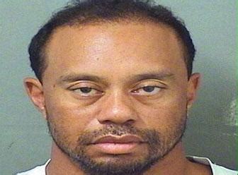 Again Tiger Woods Undergoes Another Back Surgery