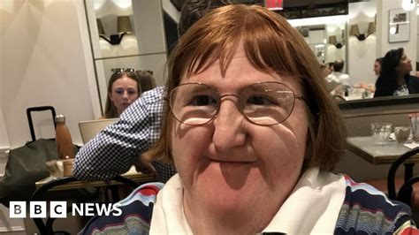 disability blogger trolls said i was too ugly for selfies so i hit back