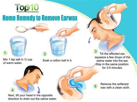 If you have a persistent problem with cerumen, your doctor may recommend irrigating your ear, a procedure also known as syringe. Home Remedies to Remove Earwax | Top 10 Home Remedies