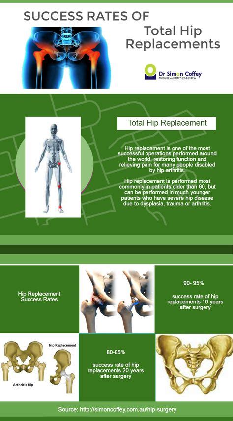 25 Best Total Hip Replacement Surgery Recovery Images Hip