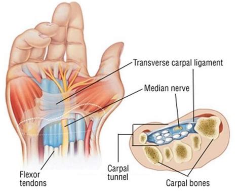 Carpal Tunnel Anatomy The Orthopedic And Sports Medicine Institute In