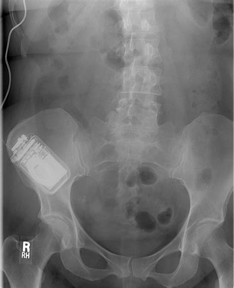 April 2018 Case Quiz Discussion Atlas Radiology Consultants