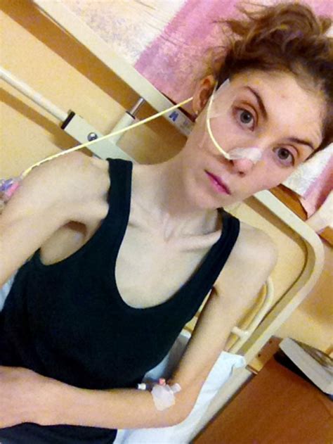 Former Anorexic Is Now A Gym Bunny And Is On A Mission To Help Others In Recovery Metro News